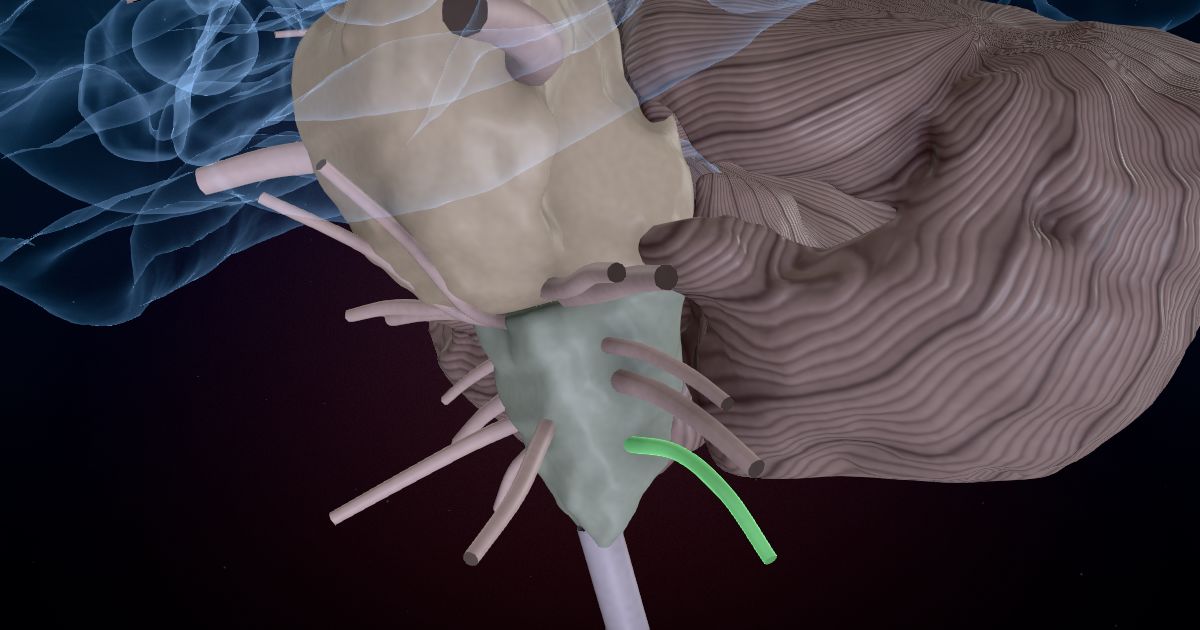 The accessory nerve (XI) lit up in a 3D model of the human brain