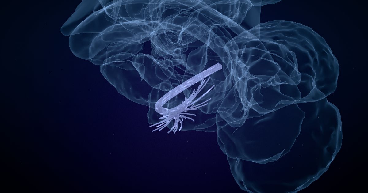 The acoustic radiation in a 3D model of the brain