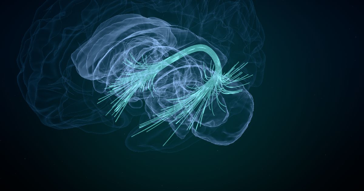 The arcuate fasciculus in a 3D model of the brain