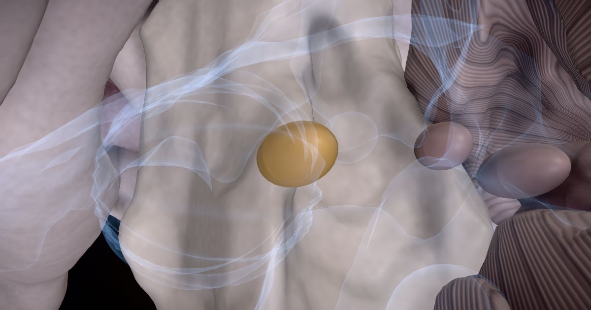 The interposed nucleus lit up in a 3D model of the human brain