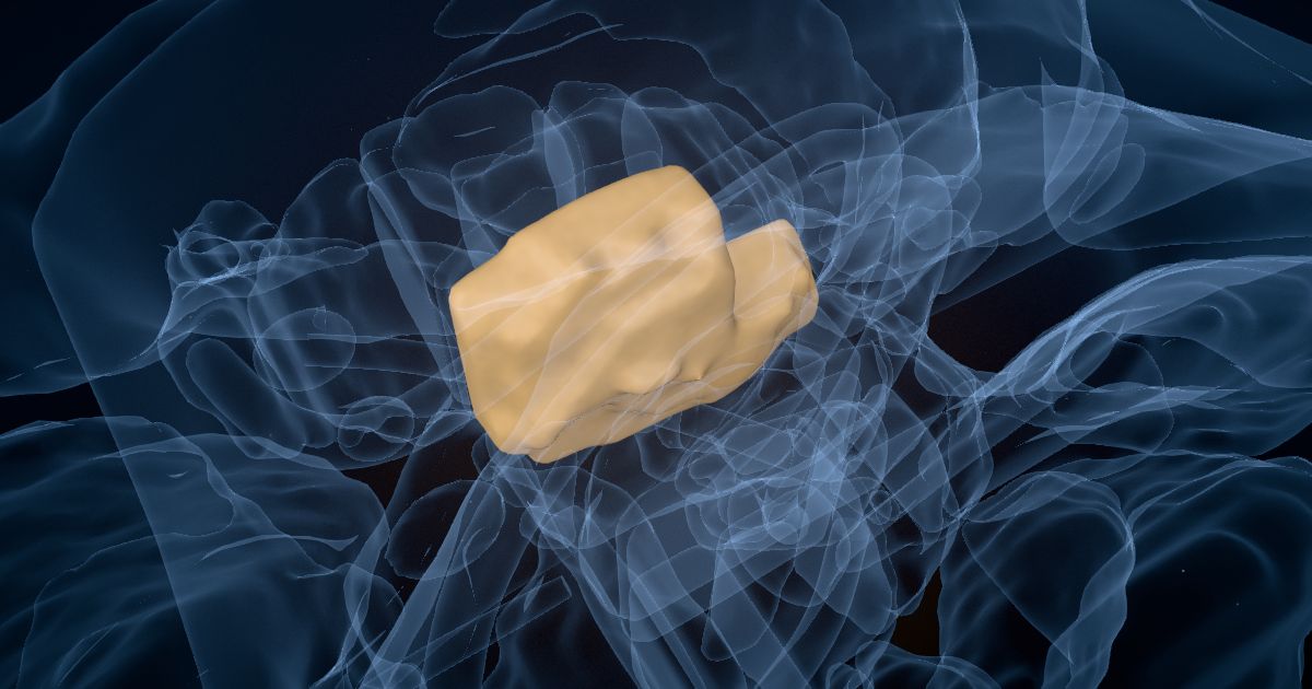 The mediodorsal nucleus of the thalamus in a 3D model of the brain