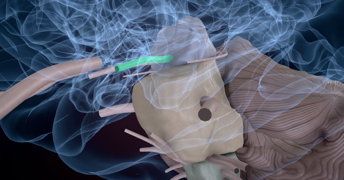 The oculomotor nerve (III) in a 3D model of the brain
