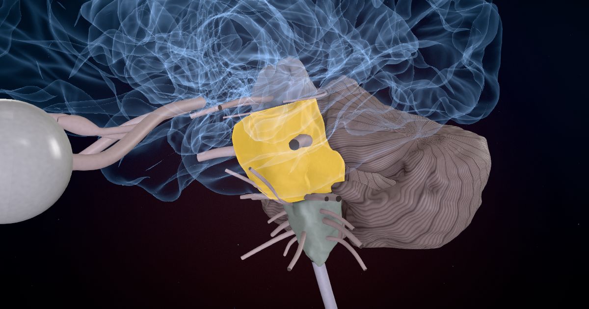 The pons in a 3D model of the brain