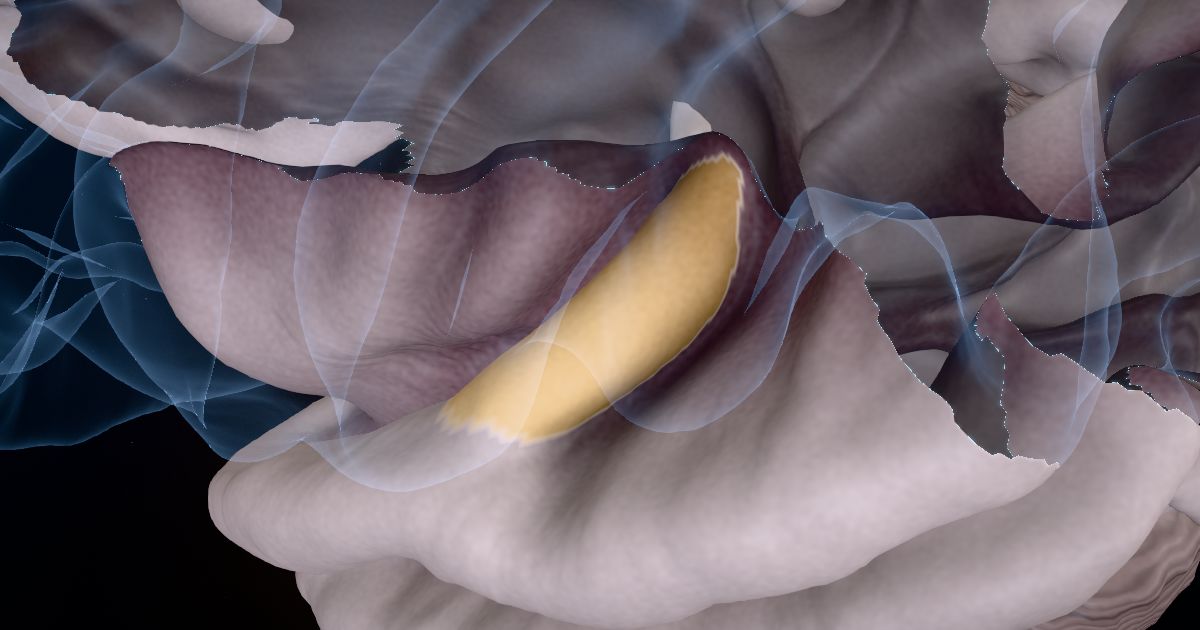 Language in a 3D model of the brain