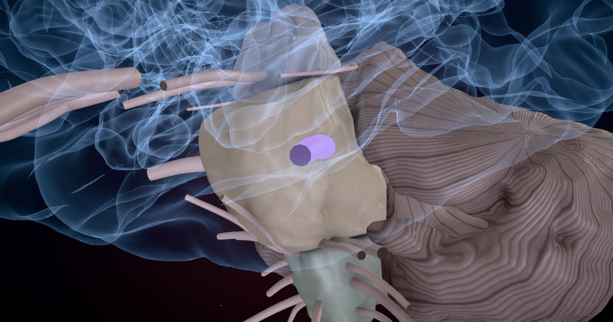 The trigeminal nerve (V) in a 3D model of the brain