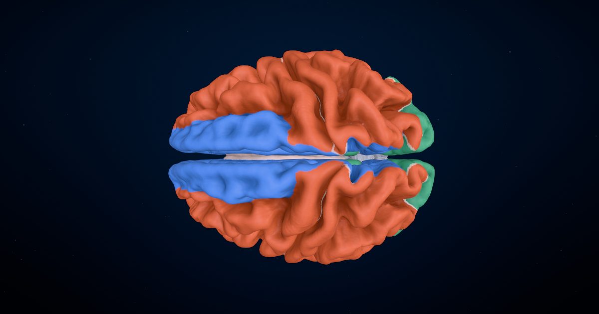 A 3D brain seen from the top, colored by the artery that feeds each area